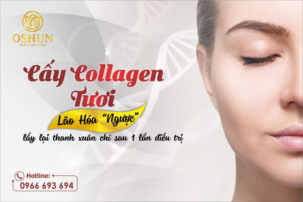 Cấy collagen tươi