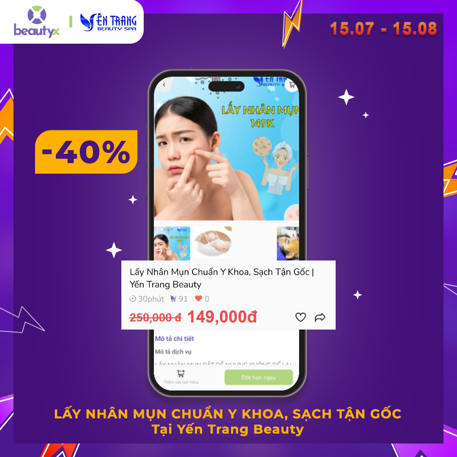 khuyến mãi Lấy nhân mụn chuẩn y khoa beautyx -40%