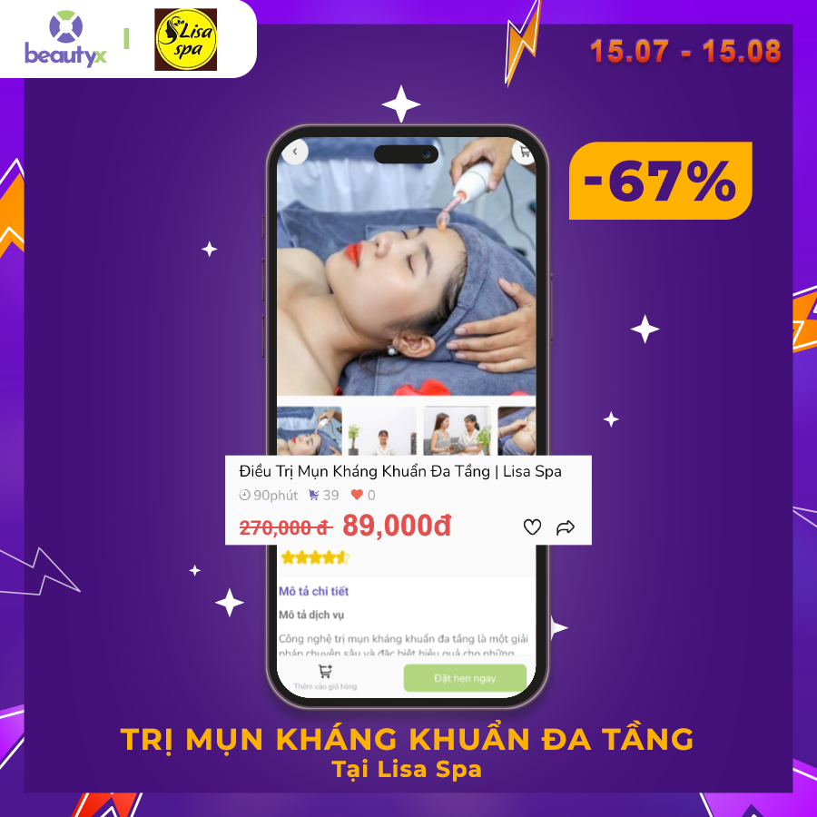 Điều trị mụn kháng khuẩn đa tầng giảm giá trên app beautyx còn 89k