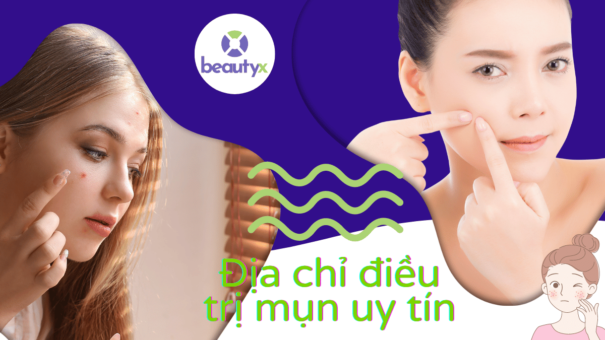 Có nên đi nặn mụn ở Spa? 8 Địa chỉ điều trị mụn uy tín TPHCM