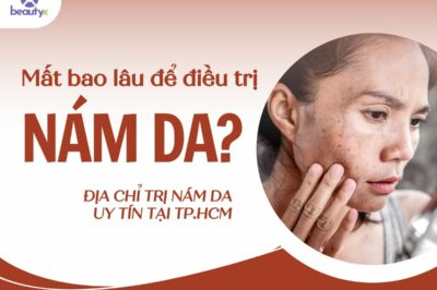 Cần bao lâu để điều trị nám da? Gợi ý địa chỉ trị nám uy tín ở TP.HCM