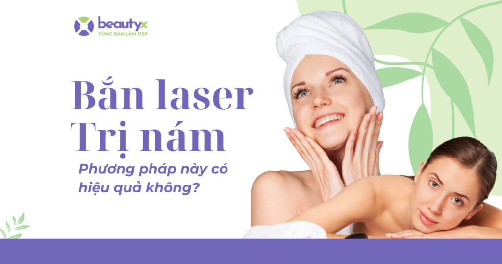 Bắn laser trị nám - Phương pháp này có hiệu quả không?