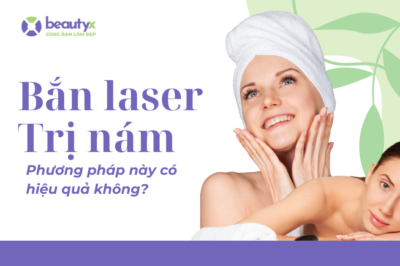 Bắn laser trị nám – Phương pháp này có hiệu quả không?