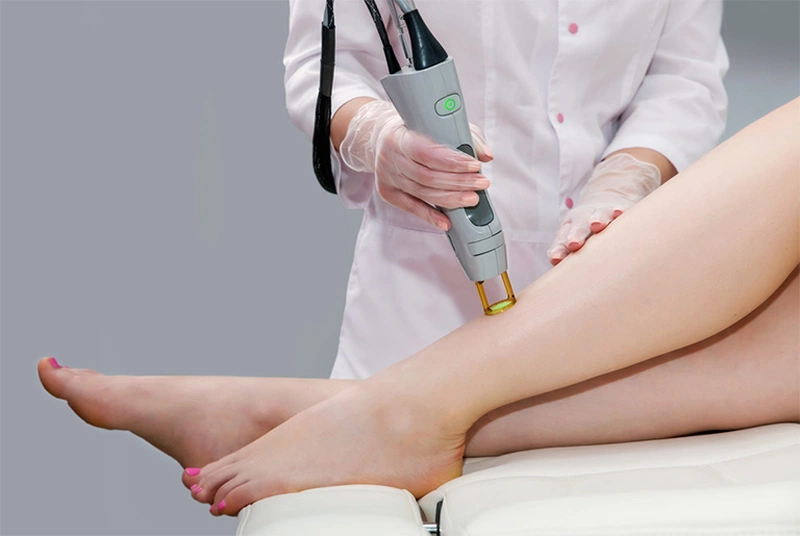 Trị viêm nang lông bằng laser hiệu quả cao