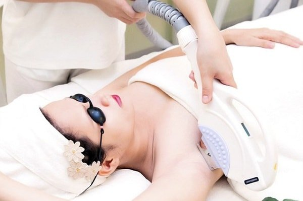 Triệt lông laser hiệu quả và rất được ưa chuộng