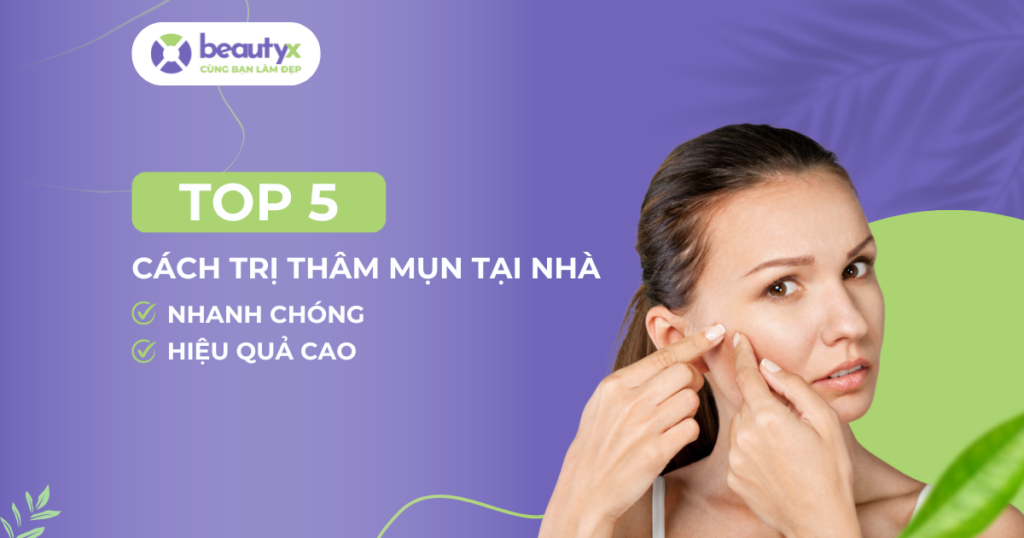 Top 5 cách trị thâm mụn hiệu quả, nhanh chóng tại nhà