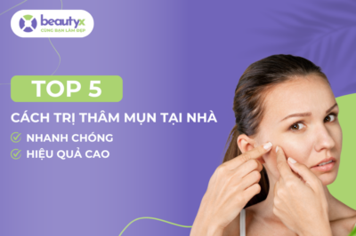 Top 5 cách trị thâm mụn hiệu quả, nhanh chóng tại nhà