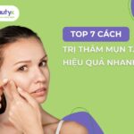 Top 7 cách trị thâm mụn tại nhà hiệu quả nhanh chóng